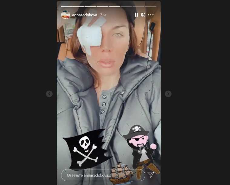 Певица Седокова сообщила об экстренной операции. «Решила резать»
