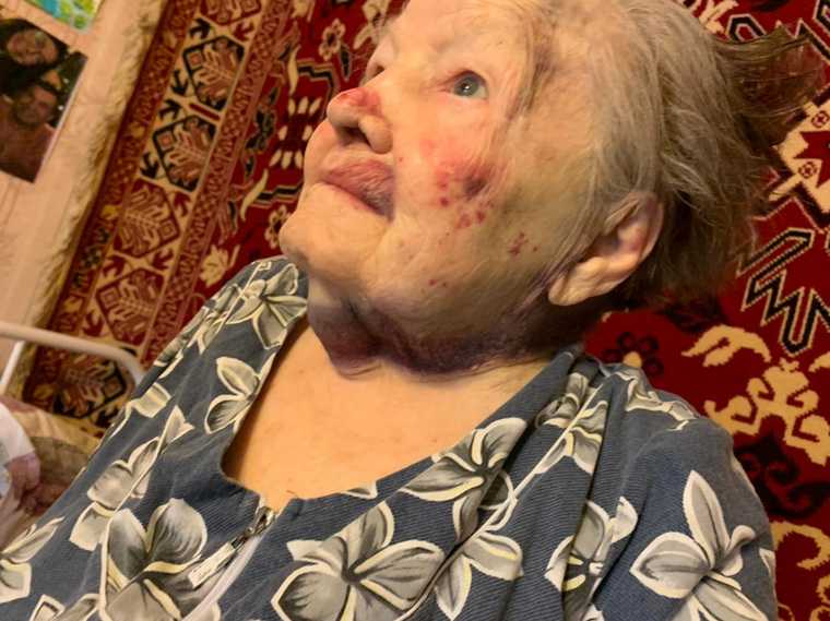 В Екатеринбурге умерла бабушка, которую избила сиделка. Фото